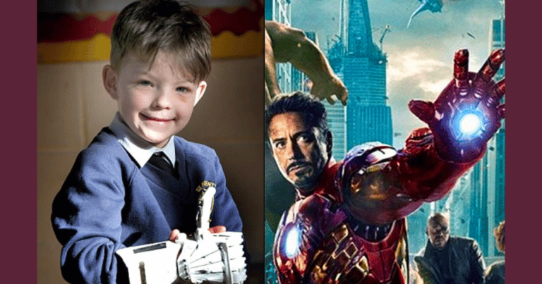 Young Boy is Born With Rare Deformity – Then 1 Genius Idea Grants Him a “Super Power”