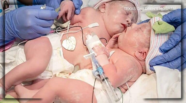 Heart-Stopping Ultrasound Leaves Parents In Tears – To Save The Babies, They Make A Painful Choice