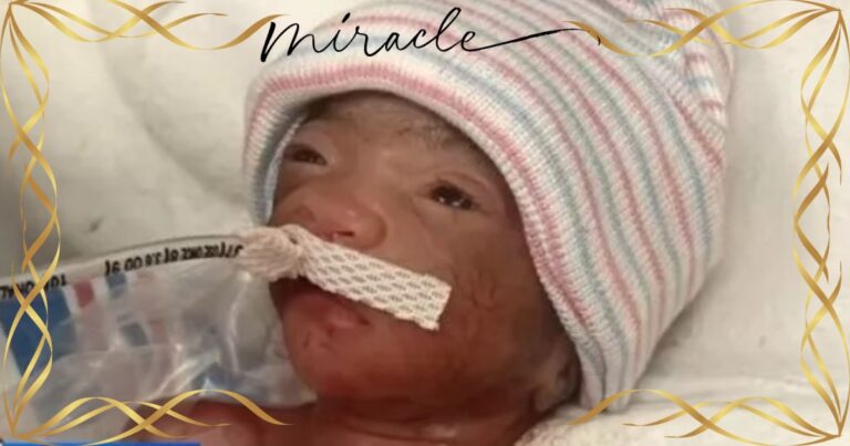 ‘Miracle Baby’ Leaves Doctors Stunned – You Won’t Believe How Much He Weighed At Birth