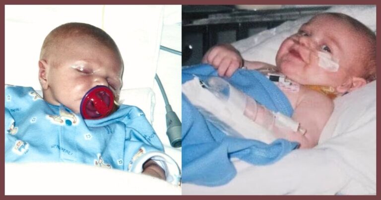 2 Babies Born With Extremely Rare Defect – A Surprise 21 Years Later Stuns Both Moms