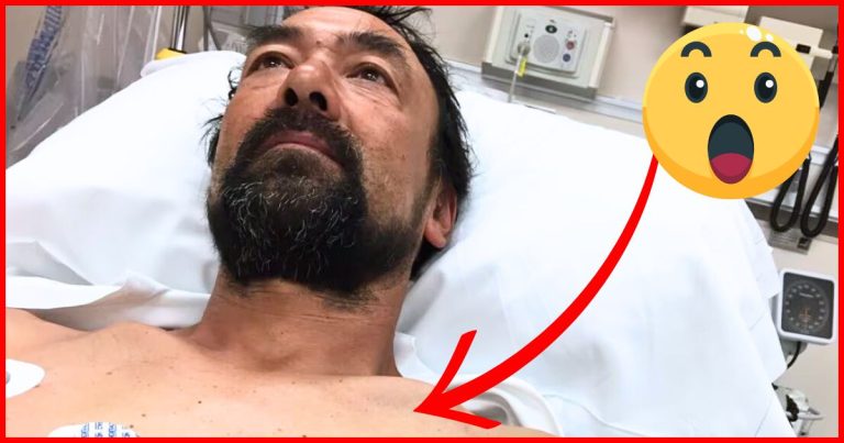 Man Suffers Freak Accident At Home – When Wife Sees His Chest, She Can’t Believe Her Eyes